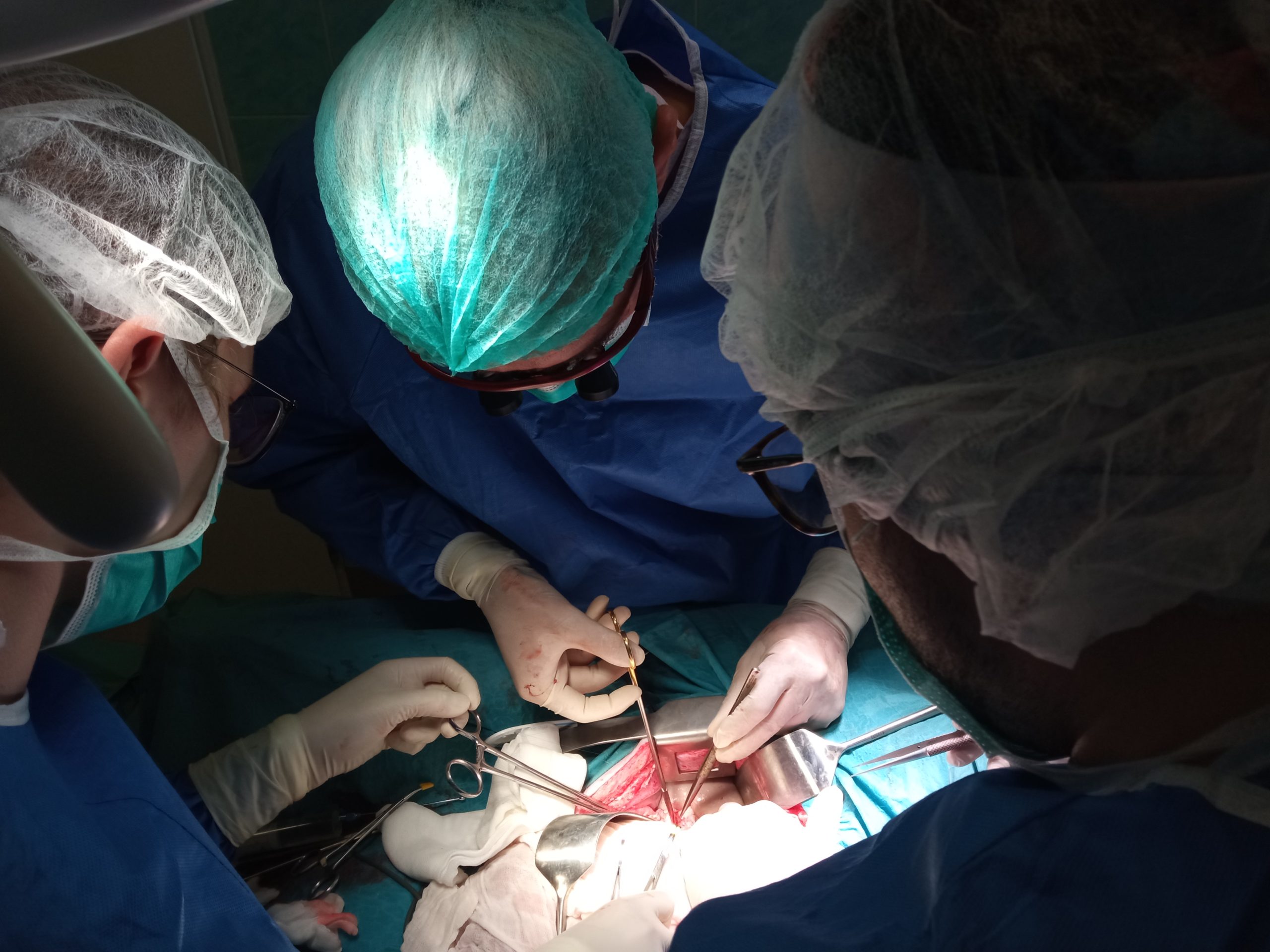 trzech chirurgów w trakcie autotransplantacji nerki